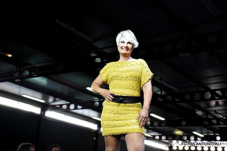 Algunas de las pacientes se convirtieron en modelos para dar un ejemplo de superación  (Foto Antonio Alí)